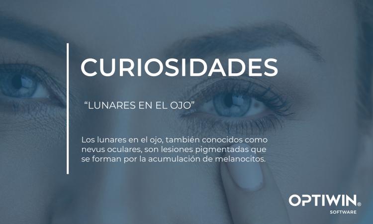 LUNARES EN EL OJO:¿QUÉ SON LOS LUNARES EN EL OJO Y POR QUÉ DEBES VIGILARLOS?