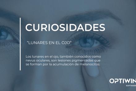 LUNARES EN EL OJO:¿QUÉ SON LOS LUNARES EN EL OJO Y POR QUÉ DEBES VIGILARLOS?