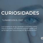 LUNARES EN EL OJO:¿QUÉ SON LOS LUNARES EN EL OJO Y POR QUÉ DEBES VIGILARLOS?